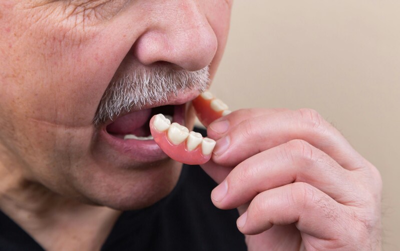free dentures for low-income adults