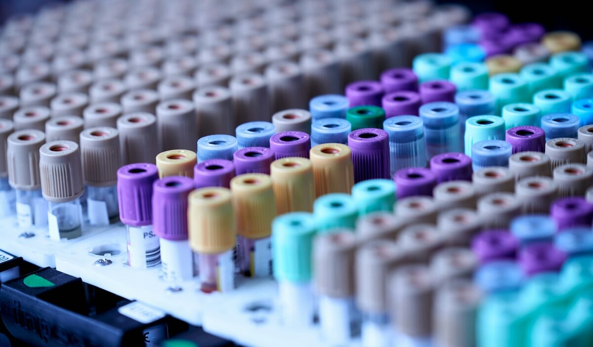 does medicaid cover dna testing