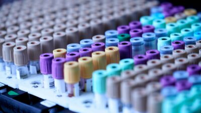 does medicaid cover dna testing