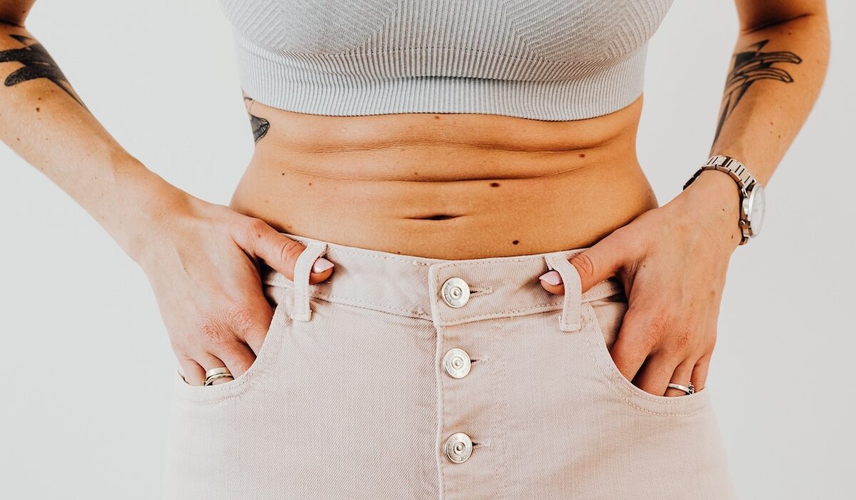 doctors who accept medicaid for tummy tucks