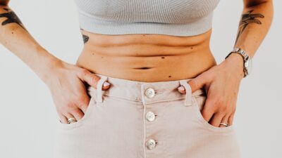 doctors who accept medicaid for tummy tucks