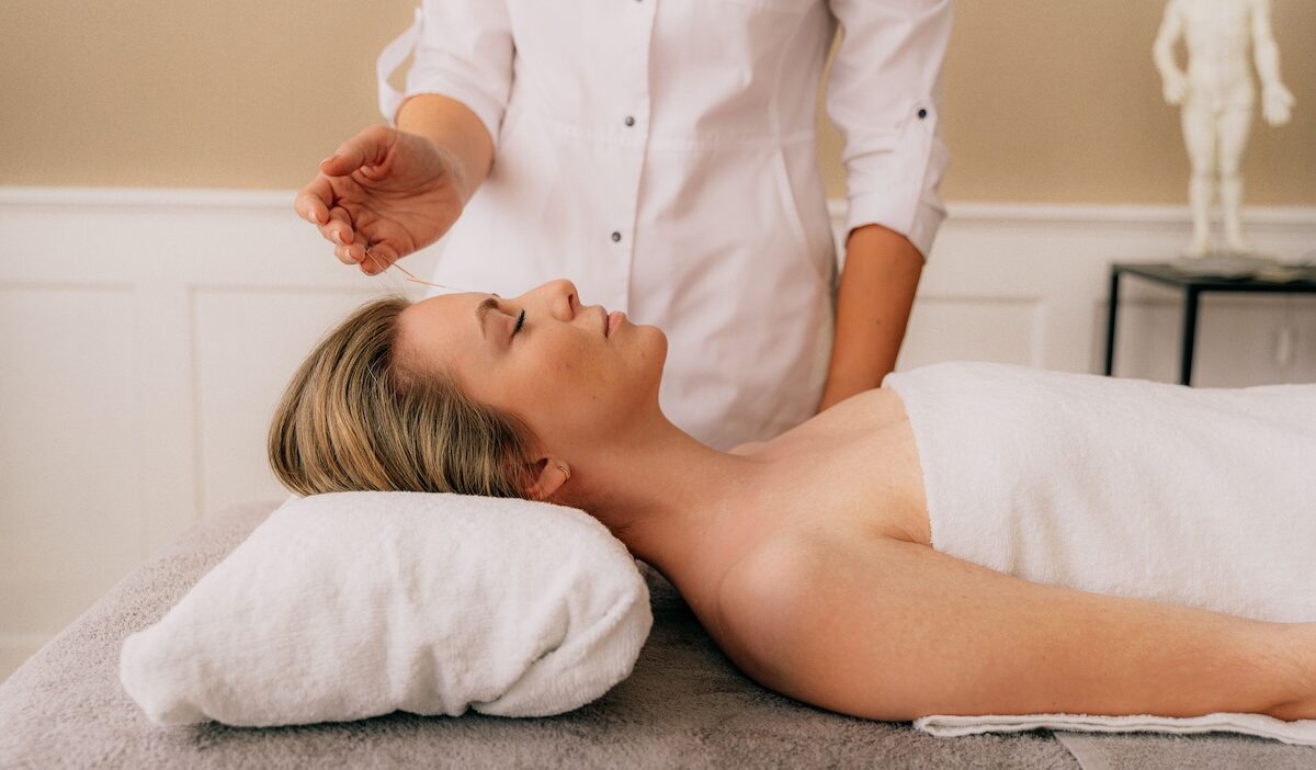 does medicaid cover acupuncture