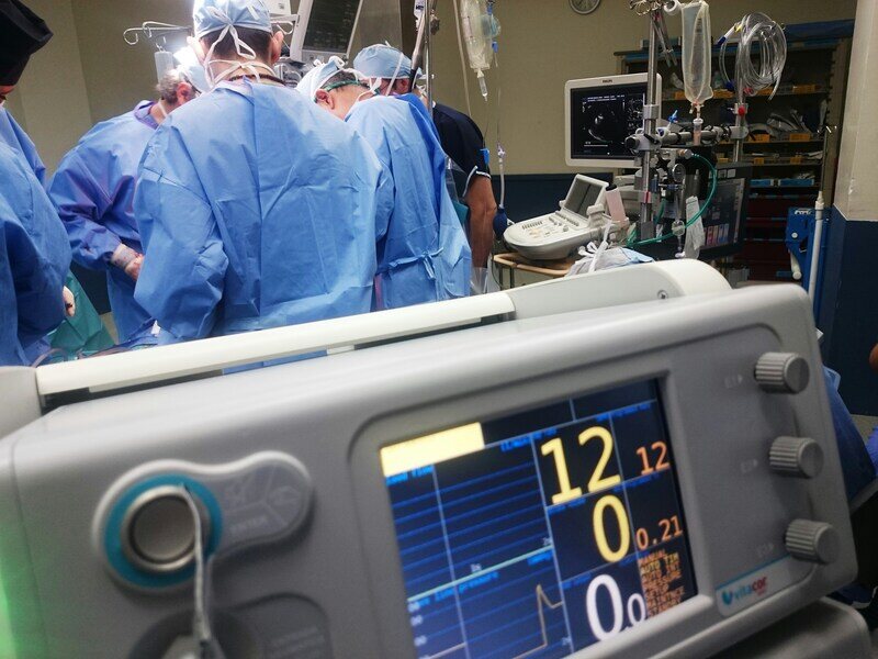 does medicaid cover cpap machines