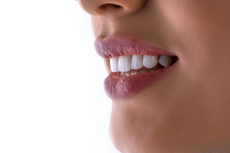 does medicaid cover veneers