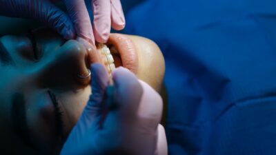 does medicaid pay for braces