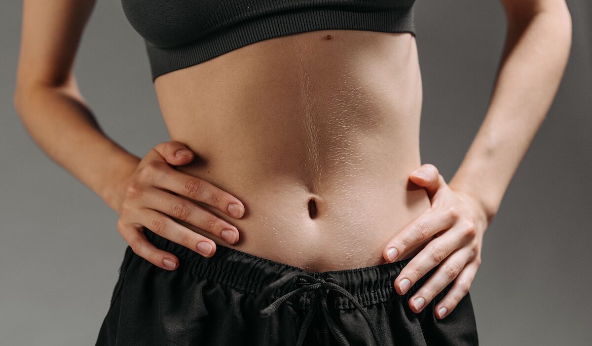 how to get medicaid to cover tummy tuck