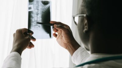 medicaid chiropractic coverage