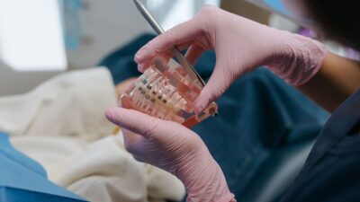 does medicaid cover braces in florida