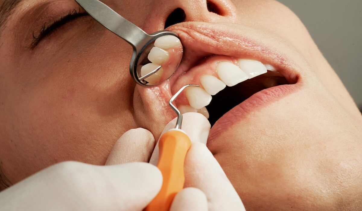 kansas dental insurance