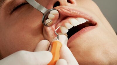 kansas dental insurance