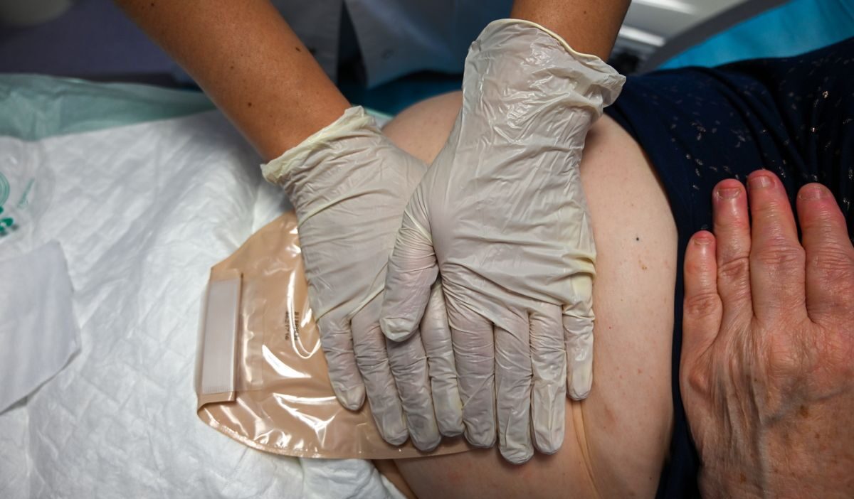 what-would-make-a-tummy-tuck-medically-necessary